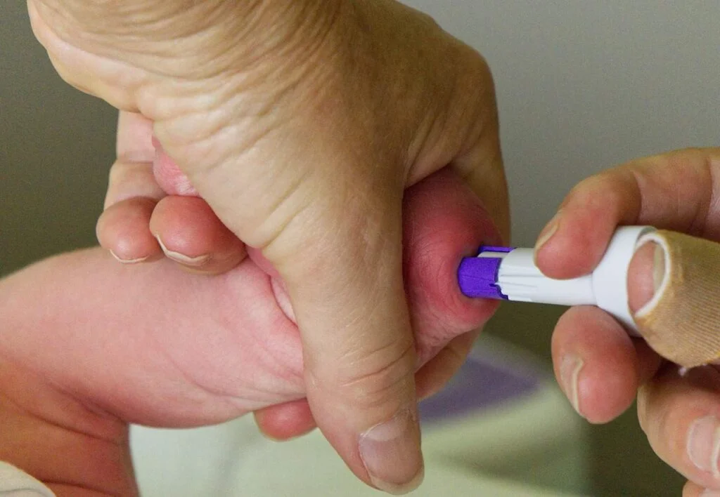 Diseases Included in Newborn Screening Tests